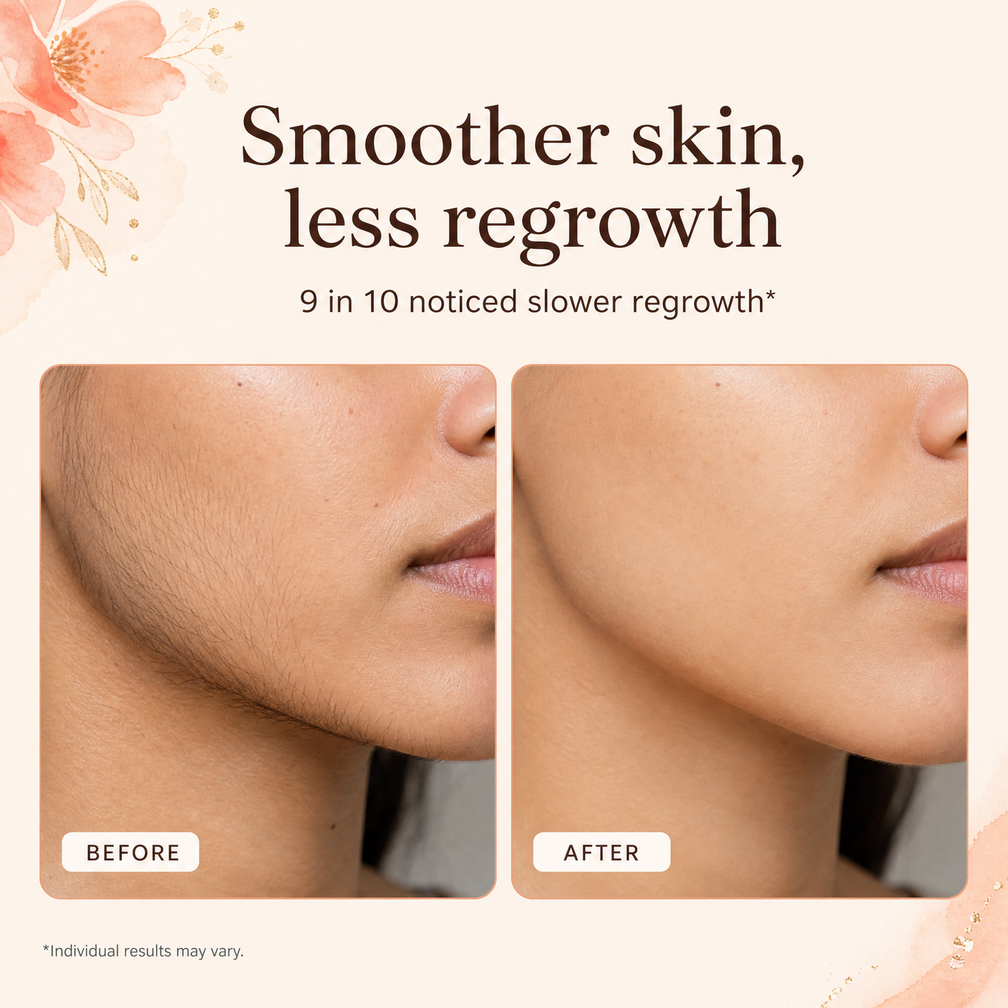 Peach Sands™ Cyperus Rotundus Oil: Organic Hair Removal
