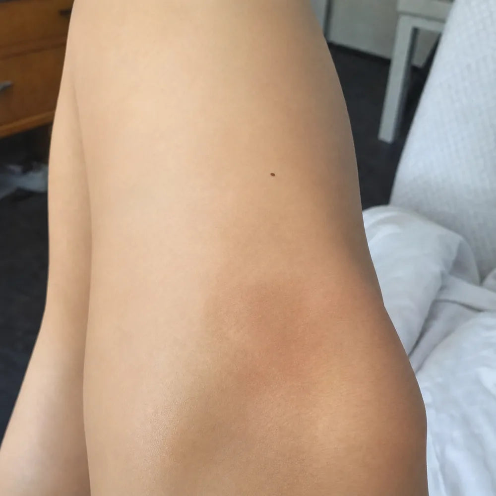 Knees after Peach Sands