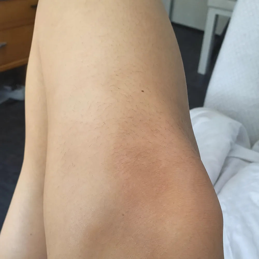 Knees before Peach Sands