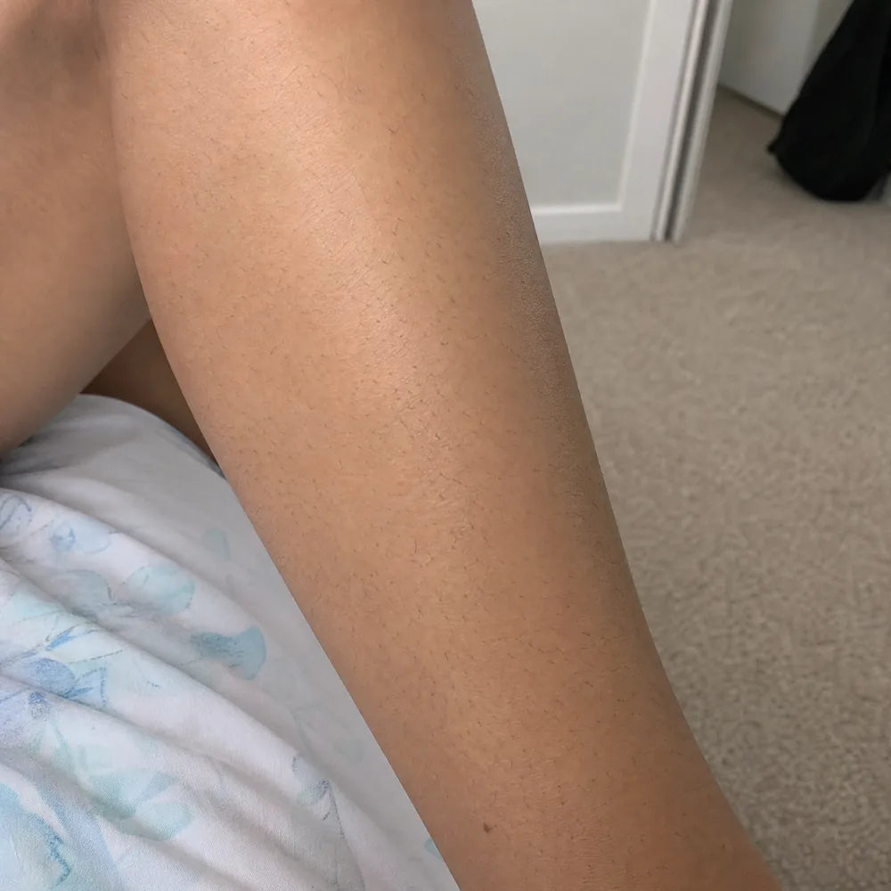 Legs before Peach Sands