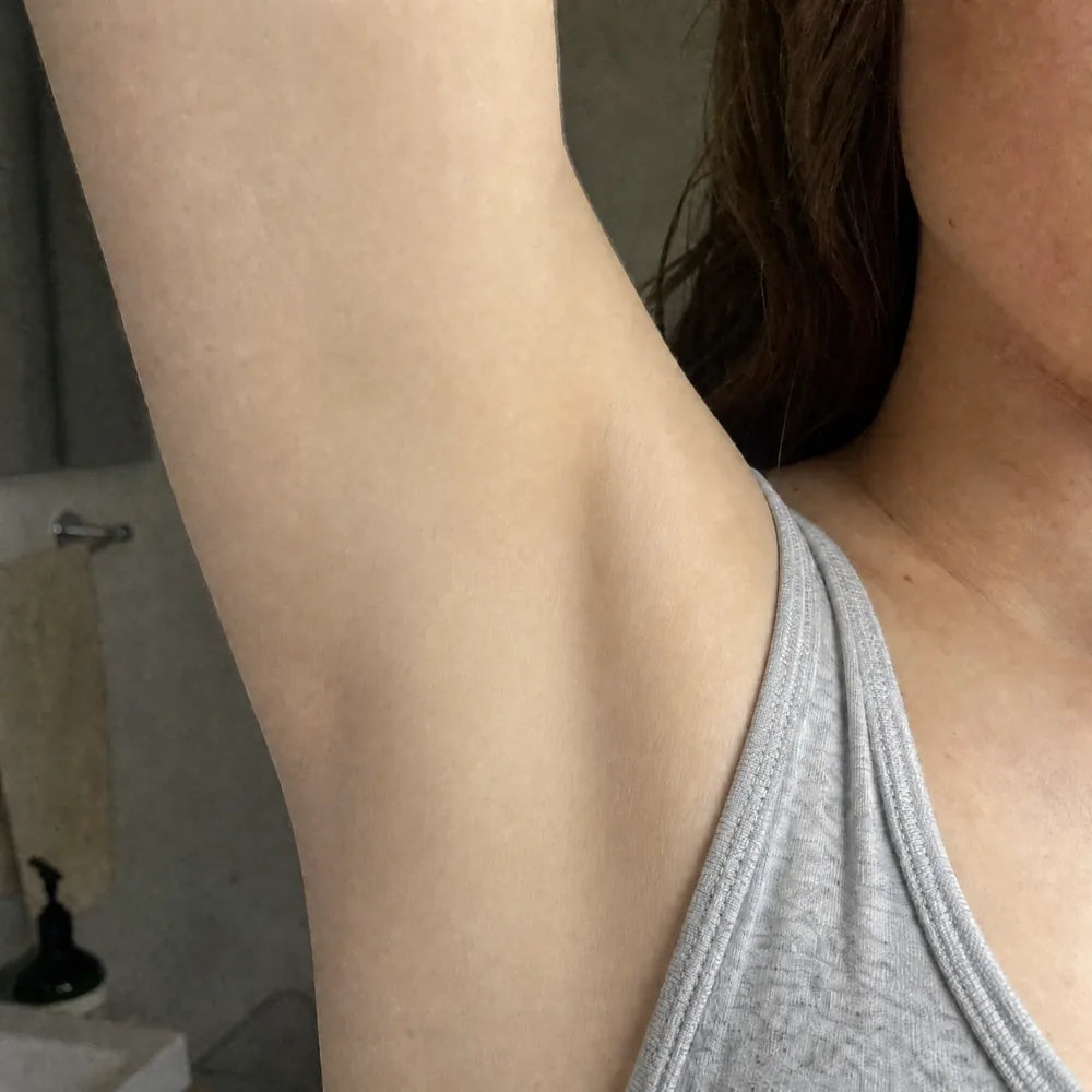 Underarms after Peach Sands