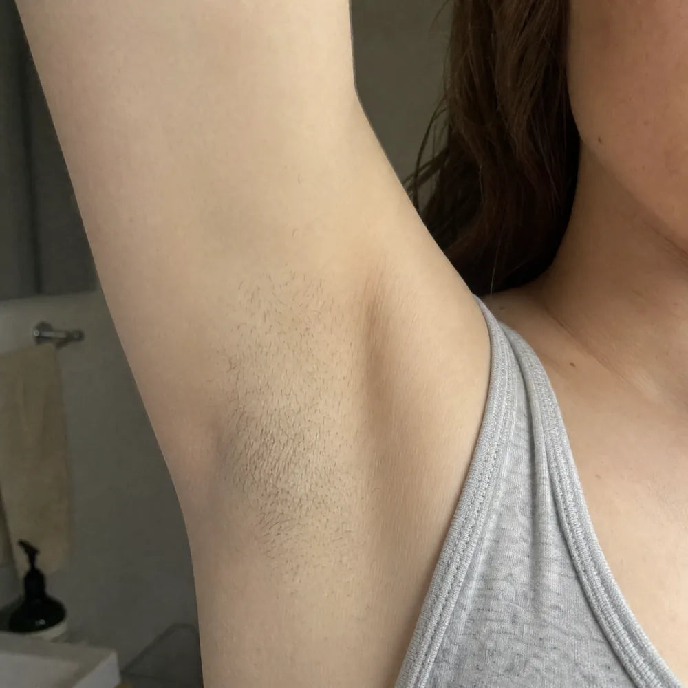 Underarms before Peach Sands