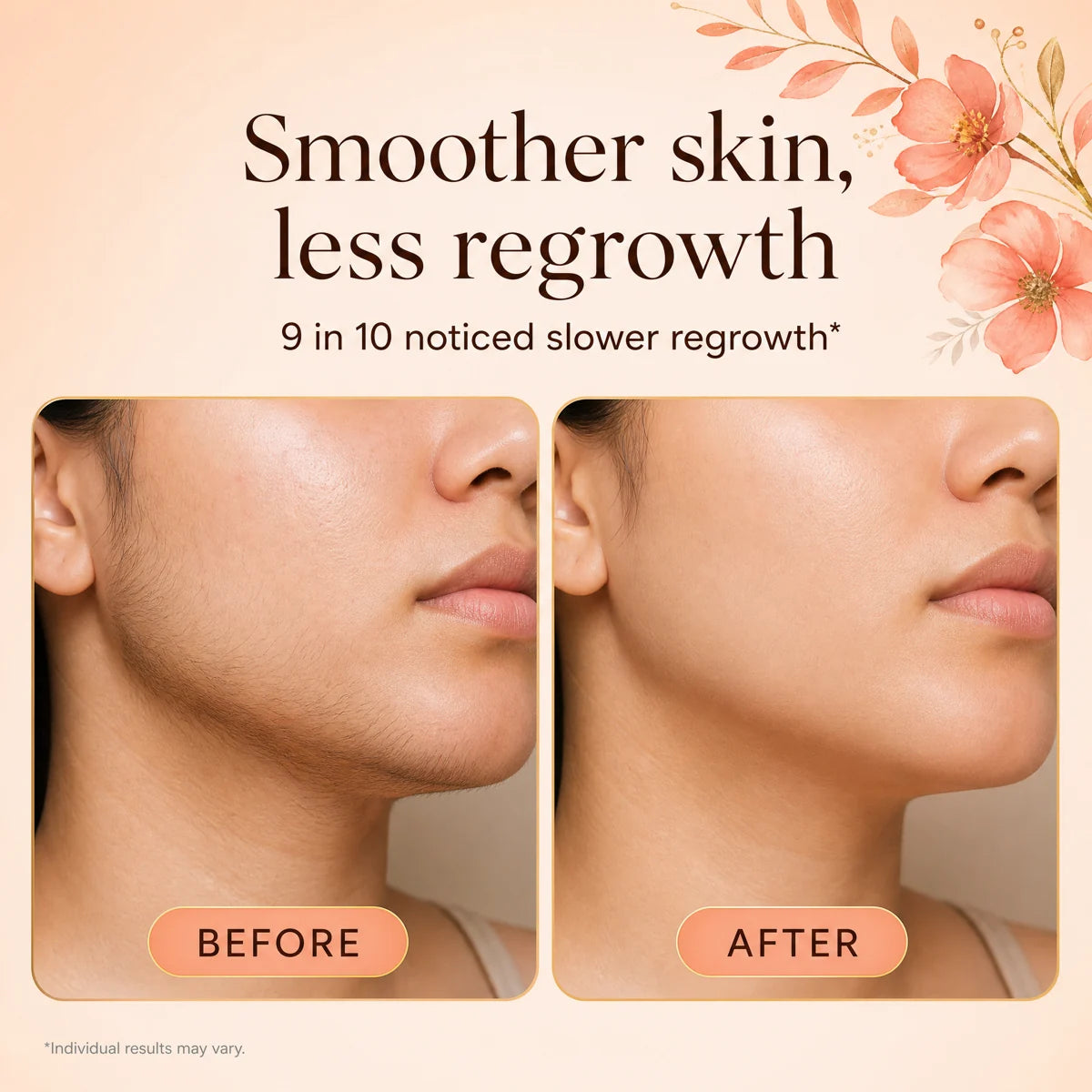 Before and after results on the face